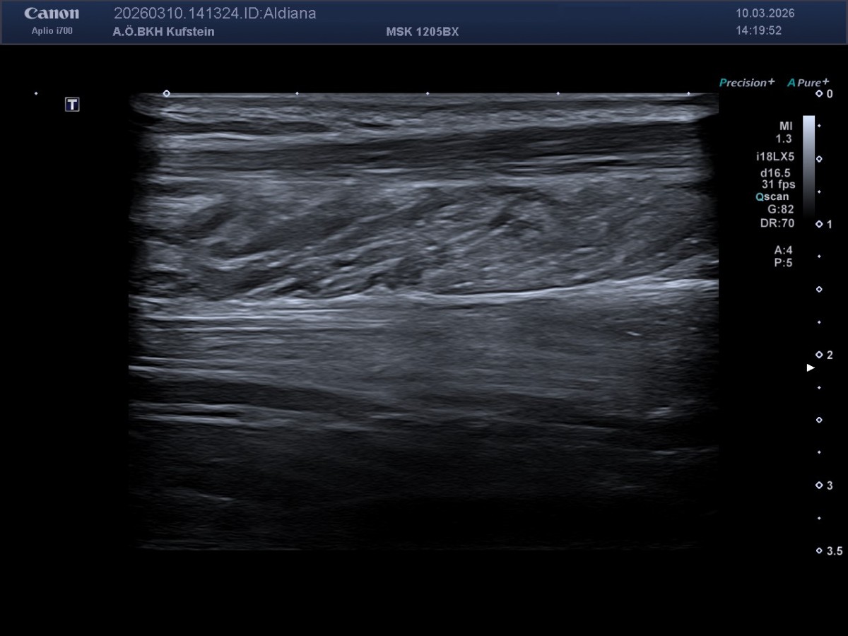 MedETeCh im KH Kufstein | BRG Wörgl