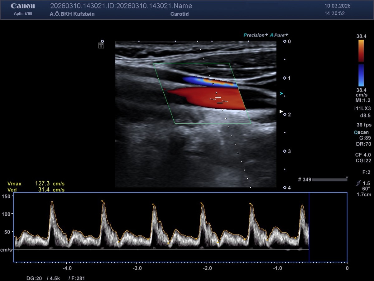 MedETeCh zu Besuch im Krankenhaus Kufstein