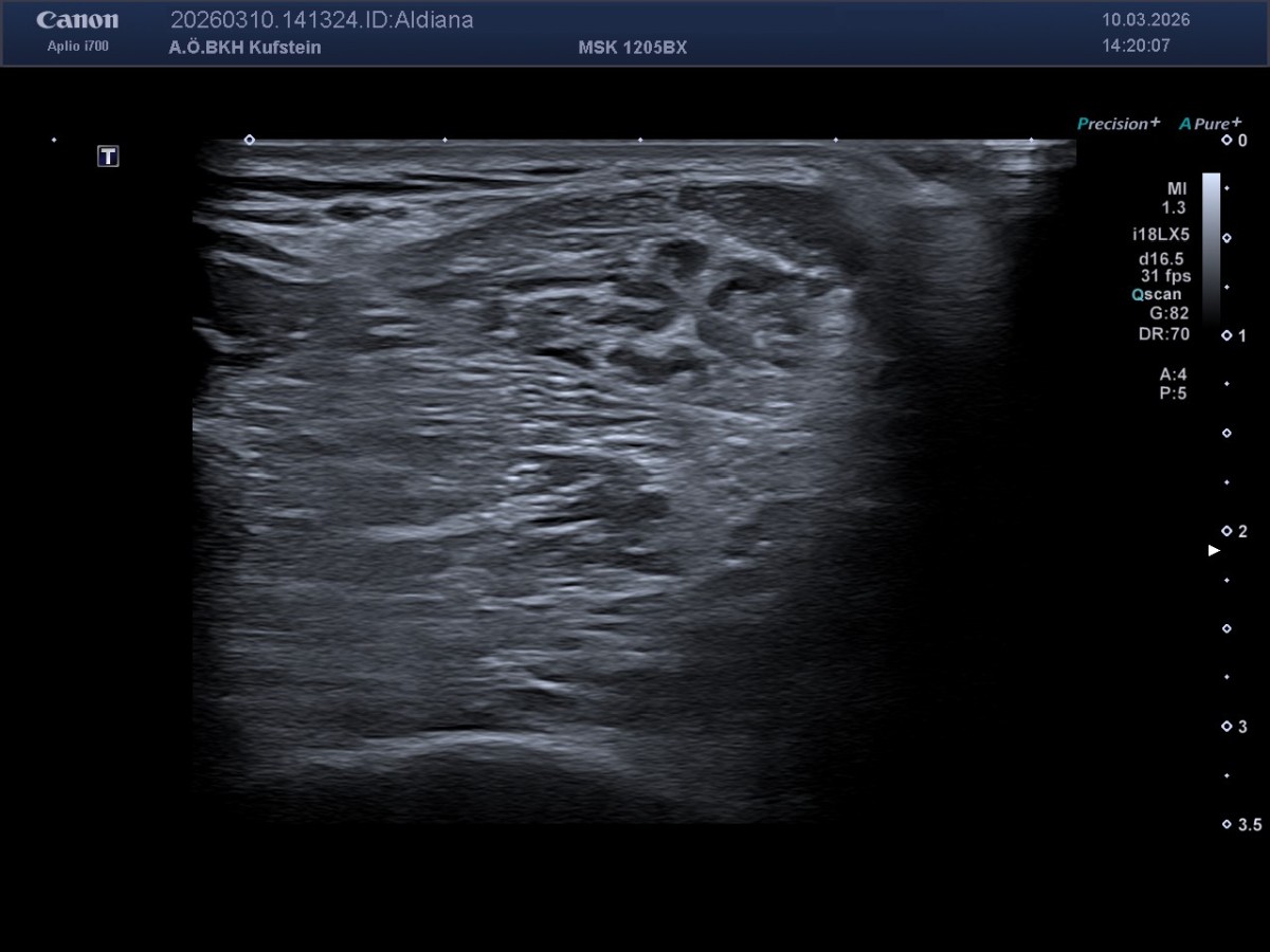 MedETeCh im KH Kufstein | BRG Wörgl